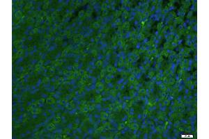 Paraformaldehyde-fixed, paraffin embedded rat stomach; Antigen retrieval by boiling in sodium citrate buffer (pH6. (ADCK4 antibody  (AA 65-170))