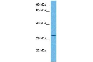 Host:  Rabbit  Target Name:  TRMT10B  Sample Tissue:  Human Stomach Tumor  Antibody Dilution:  1ug/ml (RG9MTD3 antibody  (N-Term))