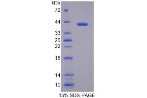 SDS-PAGE analysis of Mouse MYH1 Protein. (MYH1 Protein)