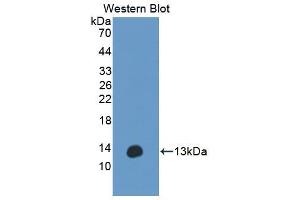Figure. (Anoctamin 6 antibody  (AA 744-824))