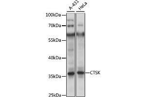 Western blot analysis of extracts of U-87MG cells, using CTSK antibody (ABIN6127669, ABIN6139234 and ABIN7101787) at 1:400 dilution. (Cathepsin K antibody  (AA 115-329))