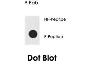 Dot blot analysis of AKT1 (phospho S129) polyclonal antibody  on nitrocellulose membrane.