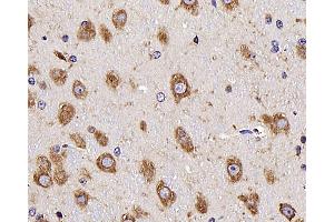 Immunohistochemistry analysis of parafffin-embedded mouse brain using NTS Polyclonal Antibody at dilution of 1:300. (Neurotensin antibody)