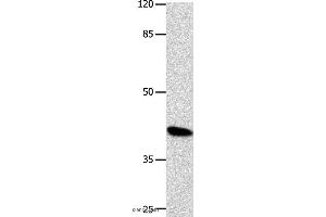 Western blot analysis of K562 cell, using POU5F1 Polyclonal Antibody at dilution of 1:500 (OCT4 antibody)