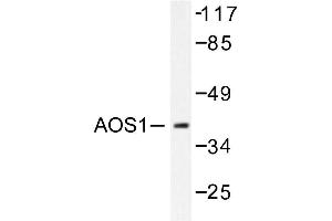 Image no. 1 for anti-SUMO1 Activating Enzyme Subunit 1 (SAE1) antibody (ABIN271943) (SAE1 antibody)