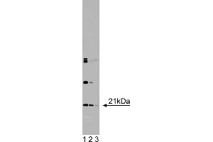 Western Blotting (WB) image for anti-Dihydrofolate Reductase (DHFR) (AA 1-186) antibody (ABIN968119) (Dihydrofolate Reductase antibody  (AA 1-186))
