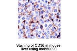 Image no. 1 for anti-CD36 (CD36) antibody (ABIN363244) (CD36 antibody)