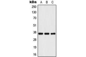 Western blot analysis of IL-10 expression in Romas (A), HeLa (B), mouse liver (C) whole cell lysates. (IL-10 antibody  (Center))