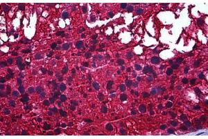 Human Testis: Formalin-Fixed, Paraffin-Embedded (FFPE) (CAPZB antibody  (AA 192-272))