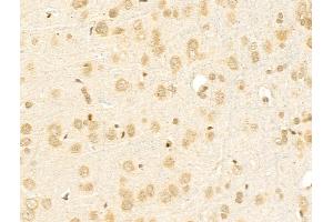 ABIN6256948 and ABIN6275299 at 1/100 staining Rat brain tissue by IHC-P. (NBPF1,9,10,12,14,15,16,20 (C-Term) antibody)