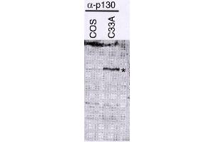 Western Blotting (WB) image for anti-Retinoblastoma-Like 2 (p130) (RBL2) (N-Term) antibody (ABIN264369) (p130 antibody  (N-Term))