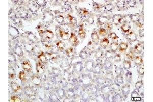 Immunohistochemistry (Paraffin-embedded Sections) (IHC (p)) image for anti-Leptin Receptor (LEPR) (AA 901-1000) antibody (ABIN725060)