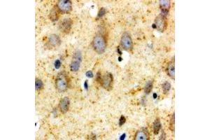 Immunohistochemical analysis of GLUR1 staining in human brain formalin fixed paraffin embedded tissue section. (Glutamate Receptor 1 antibody  (C-Term))