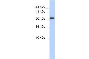 Western Blotting (WB) image for anti-Ring Finger Protein 31 (RNF31) antibody (ABIN2458723) (RNF31 antibody)