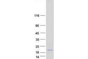 CCDC58 Protein (Coiled coil domain) (Myc-DYKDDDDK Tag)