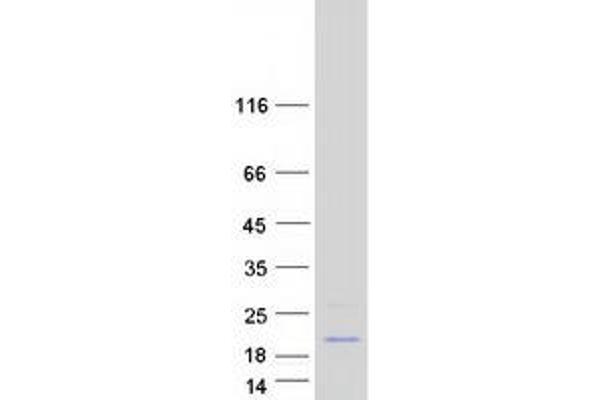 CCDC58 Protein (Coiled coil domain) (Myc-DYKDDDDK Tag)