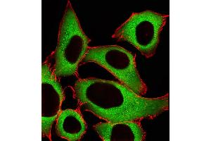 Fluorescent image of A549 cells stained with ALDH1A1 Antibody . (ALDH1A1 antibody  (AA 306-339))