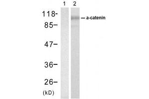 Western blot analysis of extracts from SW626 cell usingα-catenin (Ab-177) Antibody (E021521). (CTNNA1 antibody)