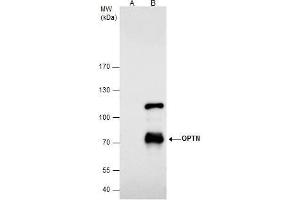 IP Image Optineurin antibody immunoprecipitates Optineurin protein in IP experiments. (OPTN antibody)