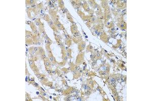 Immunohistochemistry of paraffin-embedded human gastric using STX7 antibody at dilution of 1:100 (x40 lens). (Syntaxin 7 antibody)
