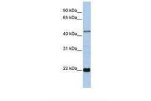 Image no. 1 for anti-Zinc Finger Protein 581 (ZNF581) (AA 72-121) antibody (ABIN6737781) (ZNF581 antibody  (AA 72-121))