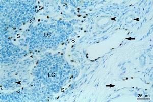 Immunohistochemical detection of endogenous PROX1 (paraffin sections) in equine mandibular lymph nodeusing anti-PROX1, pAb (dilution 1:200) , counterstained with toluidine blue. (PROX1 antibody  (AA 547-737))