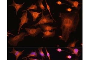 Immunofluorescence analysis of U-251MG cells using TUBB3 Polyclonal Antibody at dilution of 1:100. (TUBB3 antibody)