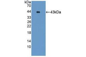 Western blot analysis of recombinant Mouse GRPR. (GRPR antibody  (AA 1-116))