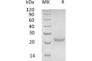 Interferon, omega 1 (IFNW) protein (His tag)