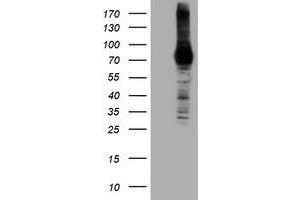 HEK293T cells were transfected with the pCMV6-ENTRY control (Left lane) or pCMV6-ENTRY DGKA (Right lane) cDNA for 48 hrs and lysed. (DGKA antibody)