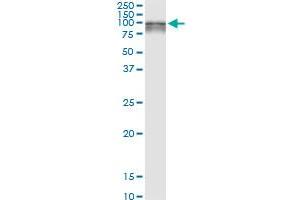 Immunoprecipitation of SILV transfected lysate using anti-SILV MaxPab rabbit polyclonal antibody and Protein A Magnetic Bead , and immunoblotted with SILV purified MaxPab mouse polyclonal antibody (B01P) . (Melanoma gp100 antibody  (AA 1-661))
