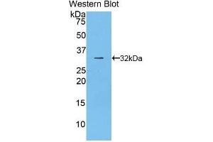 Detection of Recombinant CD2AP, Rat using Polyclonal Antibody to CD2 Associated Protein (CD2AP) (CD2AP antibody  (AA 368-623))