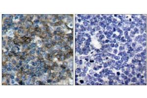 Immunohistochemical analysis of paraffin-embedded human tonsil carcinoma tissue using VASP (phospho-Ser157) antibody (E011214). (VASP antibody  (pSer157))