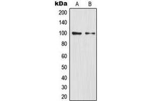 Western blot analysis of NF-kappaB p100 expression in HEK293T (A), mouse liver (B) whole cell lysates.