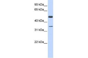 WB Suggested Anti-ZNF223 Antibody Titration:  0. (ZNF223 antibody  (Middle Region))