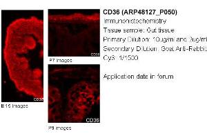 Immunohistochemistry (IHC) image for anti-CD36 (CD36) (N-Term) antibody (ABIN2783229)