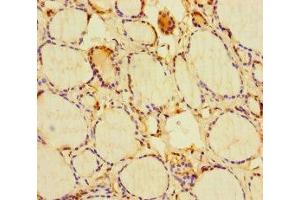 Immunohistochemistry of paraffin-embedded human thyroid tissue using ABIN7154596 at dilution of 1:100 (RIT1 antibody  (AA 1-219))