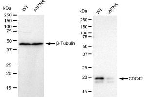 Western blotting analysis using CDC42 antibody (ABIN7798014).