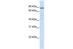 ATP6V0A2 antibody used at 1 ug/ml to detect target protein. (ATP6V0A2 antibody  (N-Term))