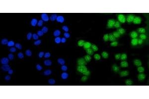 IF analysis of Androgen Receptor/AR using anti-Androgen Receptor/AR antibody (ABIN7602200). (Androgen Receptor antibody  (AA 629-920))