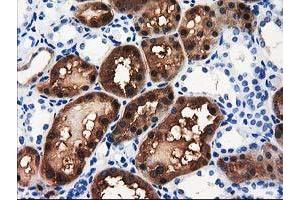 Image no. 5 for anti-Aminoacylase 3 (ACY3) antibody (ABIN1496463) (Aminoacylase 3 antibody)