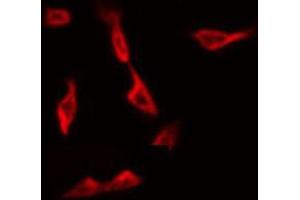 ABIN6268859 staining Hela by IF/ICC. (CYP1A1/2 antibody)