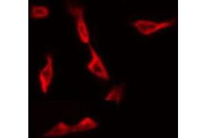 ABIN6268859 staining Hela by IF/ICC. (CYP1A1/2 antibody)