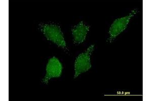 Immunofluorescence of purified MaxPab antibody to PHYH2 on HeLa cell.
