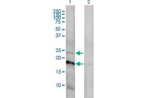 Western Blot analysis of CLDN1 expression in transfected 293T cell line by CLDN1 monoclonal antibody (M01), clone 1C5-D9. (Claudin 1 antibody  (AA 1-211))