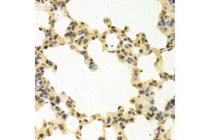 Immunohistochemistry of paraffin-embedded mouse lung using RANGAP1 antibody (ABIN5973116) at dilution of 1/100 (40x lens). (RANGAP1 antibody)