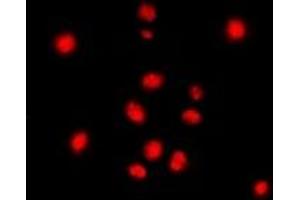 Immunofluorescent analysis of STAG3 staining in Jurkat cells. (STAG3 antibody  (C-Term))