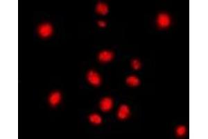Immunofluorescent analysis of STAG3 staining in Jurkat cells.