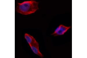 ABIN6258683 and ABIN6274711 staining Hela by IF/ICC.