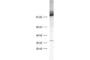 SV2C antibody